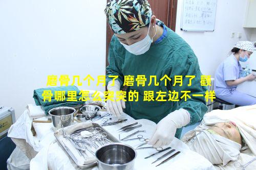 磨骨几个月了 磨骨几个月了 颧骨哪里怎么突突的 跟左边不一样
